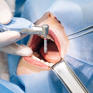 A woman undergoing dental implant surgery