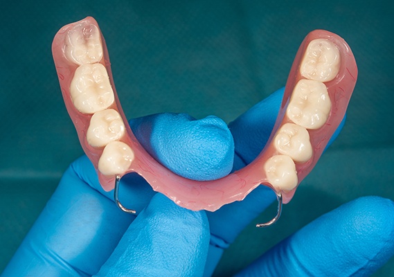 A model of partial dentures on a table at a Springfield dental office
